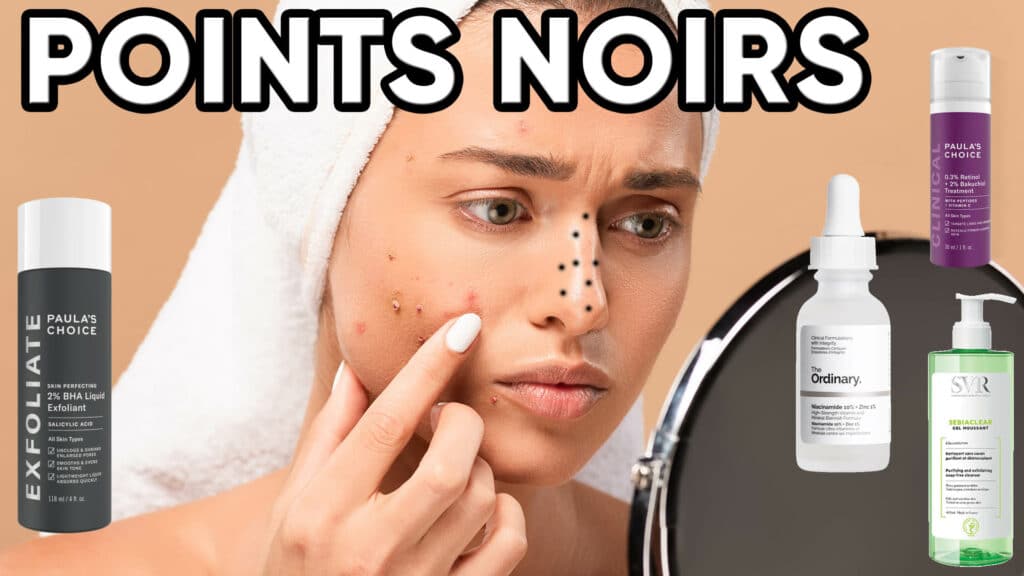 Points noirs : c'est quoi ? - Marie Claire