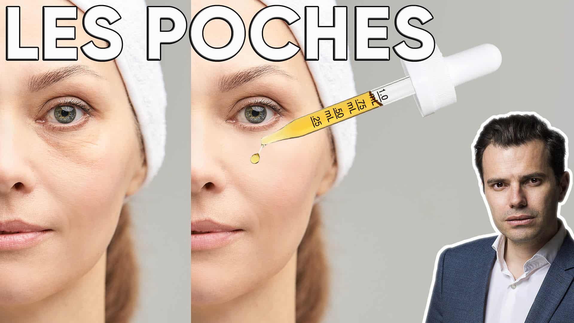 poches sous les yeux