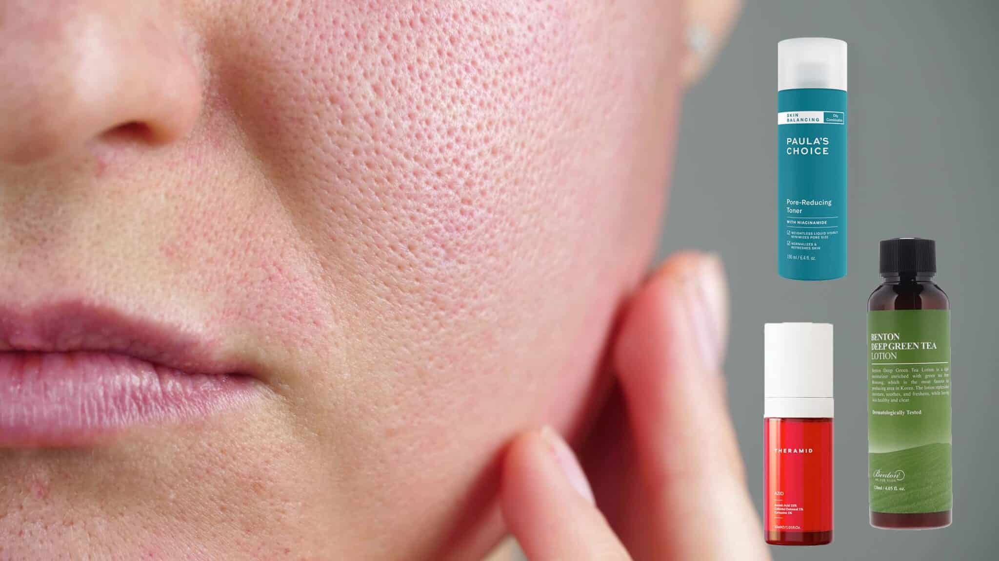 Voici les 5 meilleurs actifs pour lutter contre les pores dilatés