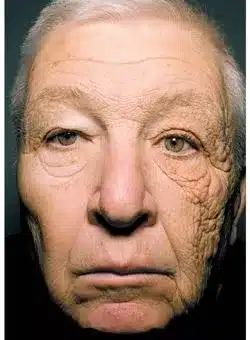 uv face
